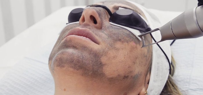 أجهزة تنظيف البشرة في العيادات
أنواع جلسات تنظيف البشرة