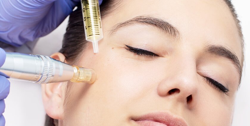 mesotherapy in Jordan