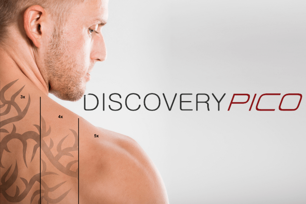 Discovery Pico laser tattoo removal