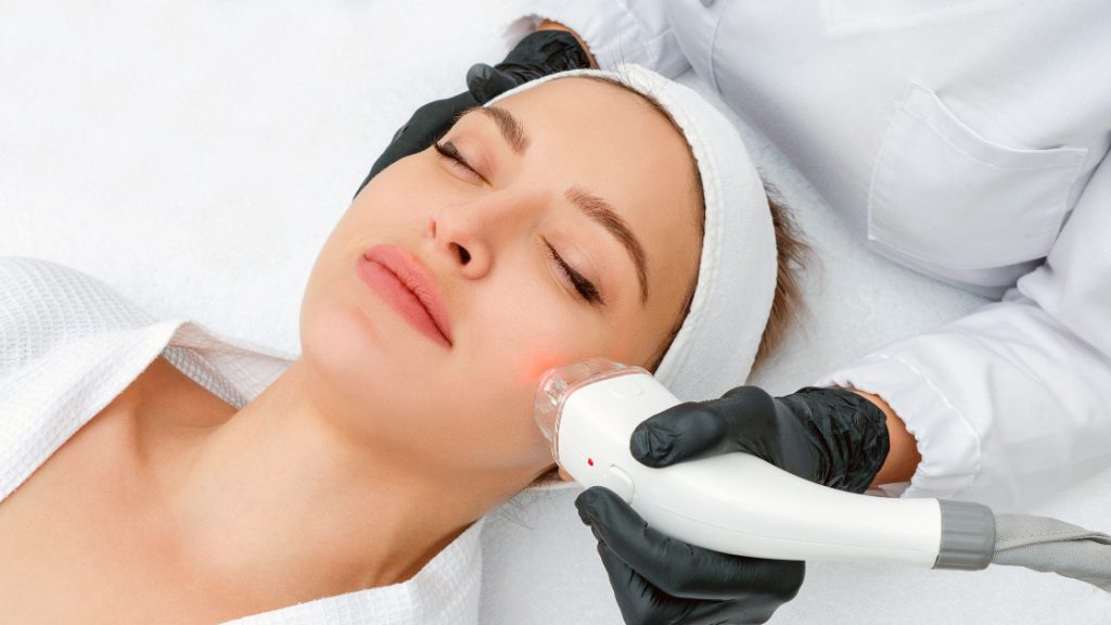 Best Laser Treatment for Acne Scars