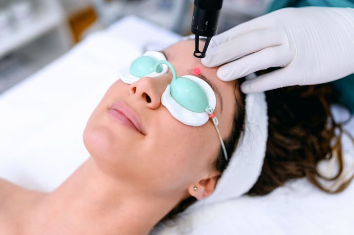 fractional picosecond laser treatment