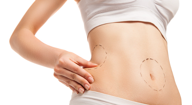 Can Laser Lipo Cause Cancer