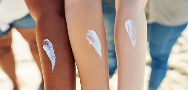 Sun exposure after laser hair removal