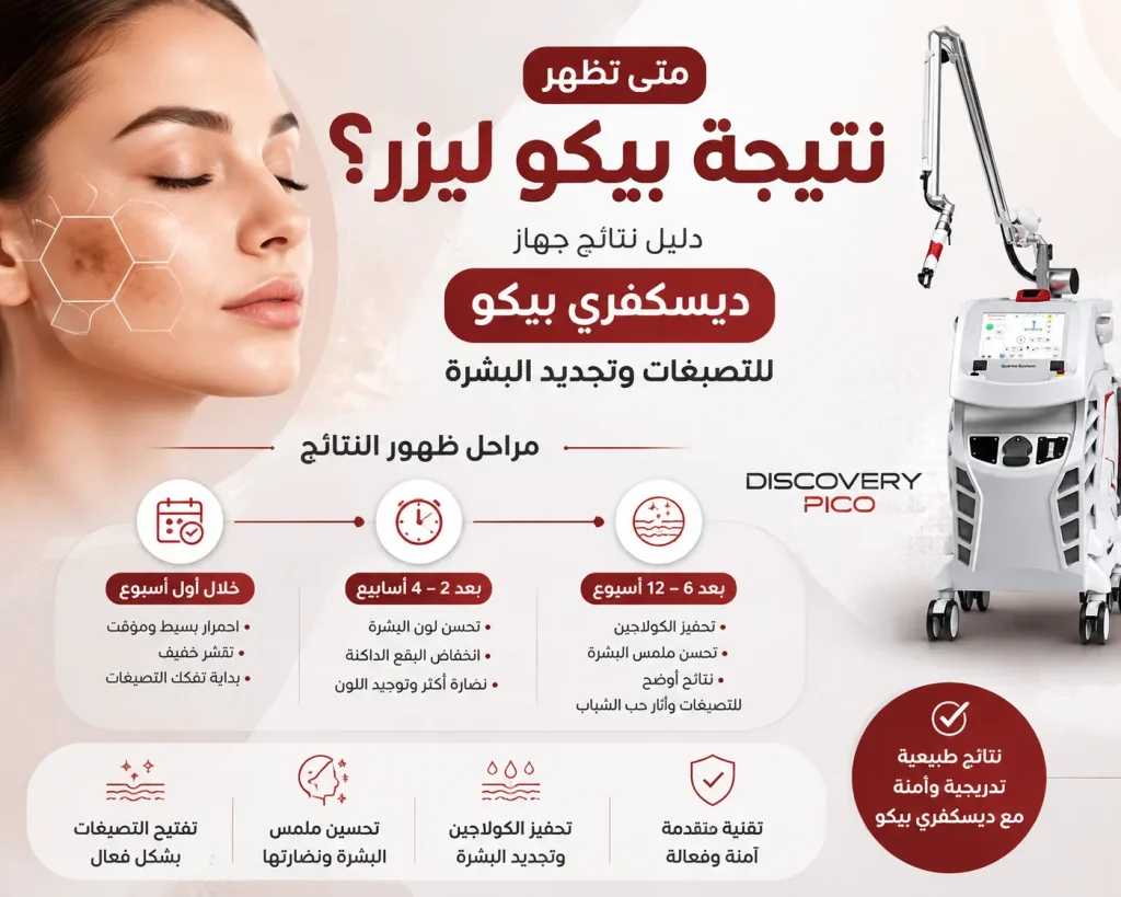 متى تظهر نتيجة ديسكفري بيكو